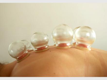 Acupuncture with Grace